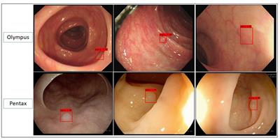 Evaluation of the competence of an artificial intelligence-assisted colonoscopy system in clinical practice: A post hoc analysis